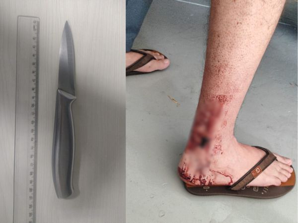 Homem é esfaqueado pela esposa durante briga em Toledo