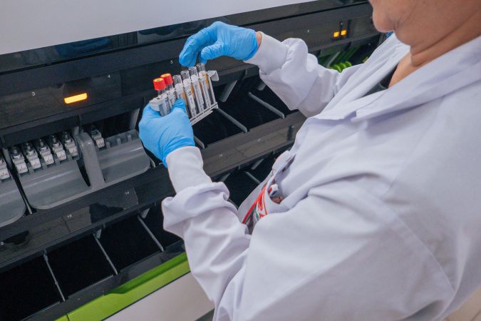 Hemepar passa a fazer testes sorológicos para aumentar segurança em transplantes